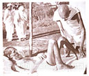 Gandhi nursing the leper patient, Segaon